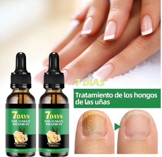 ACEITE PARA HONGOS DE UÑAS 7 DAYS 30ML
